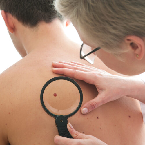 All About Cellulitis – Causes, Symptoms, And Treatment