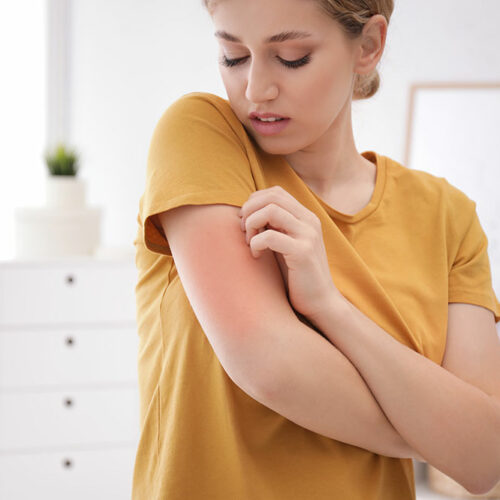 Allergies – Stages and prevention